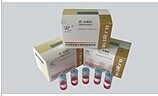 免疫球蛋白A检测试剂盒