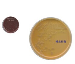 ​革兰氏阴性杆菌（GNS-16 ）药敏