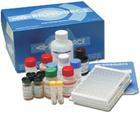 人(G-CSF)Elisa试剂盒厂家,粒细胞集落刺激因子Elisa试剂盒价格