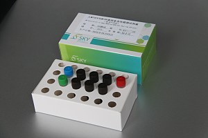 人MTHFR和MTRR基因多态性检测试剂盒（荧光PCR法）