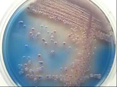 缺陷假单胞菌培养液（SLB肉汤）价格