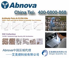 CLCN7单克隆抗体(M01), 克隆号4A3 | CLCN7 monoclonal antibody (M01), clone 4A3