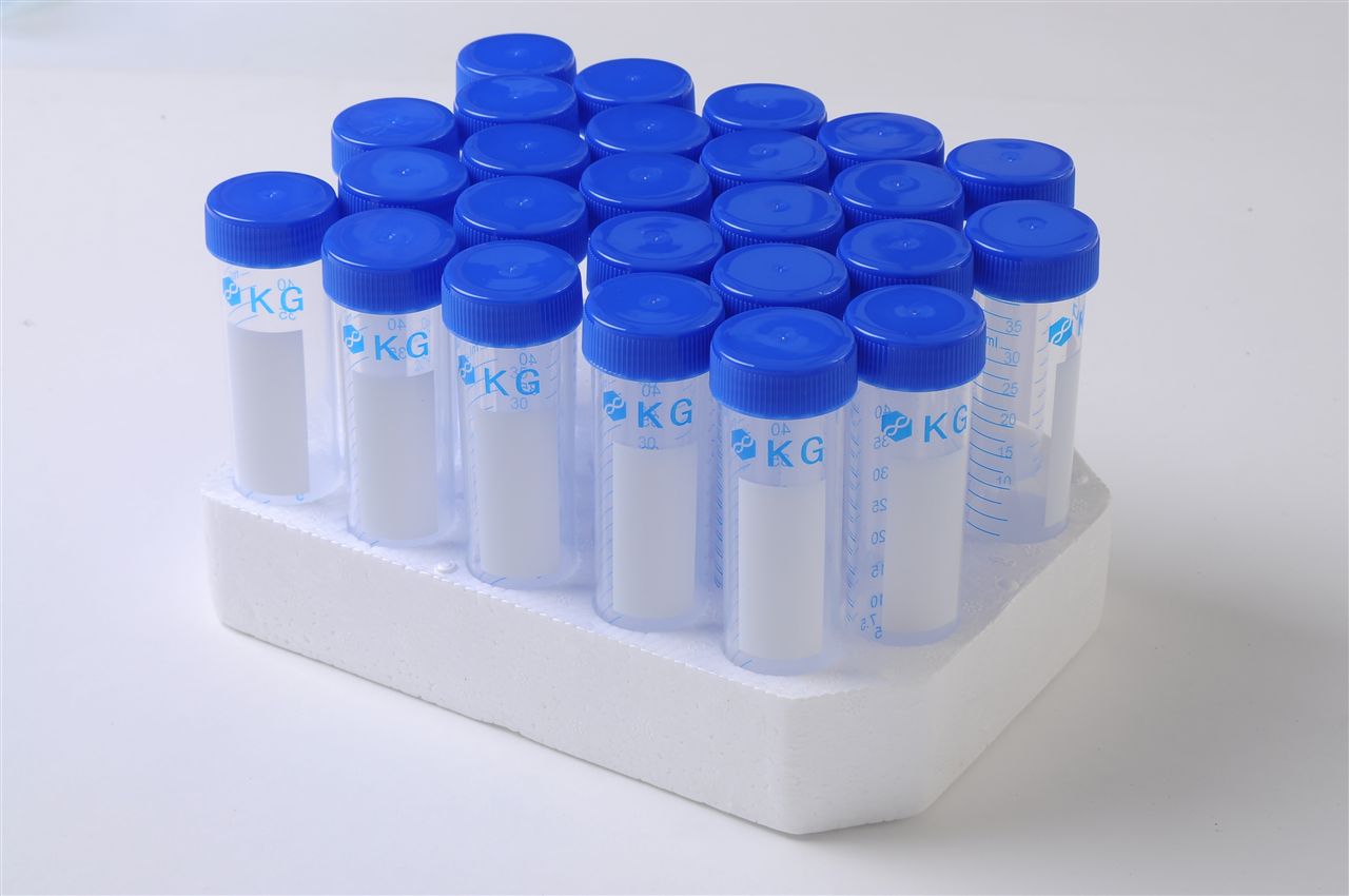 抑癌蛋白DKK1抗体