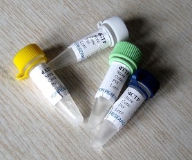 多囊肾蛋白2抗体