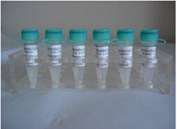 小鼠抗3-磷酸甘油醛脱氢酶单克隆抗体(内参抗体)