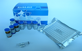 人基质金属蛋白酶1(MMP-1)elisa试剂盒【免费代测】