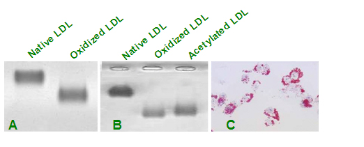 上海 氧化型低密度脂蛋白(Human Ox-LDL, OxLDL)