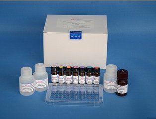 人磷酸化乙酰辅酶A(PaCoA)ELISA试剂盒实验结果分析