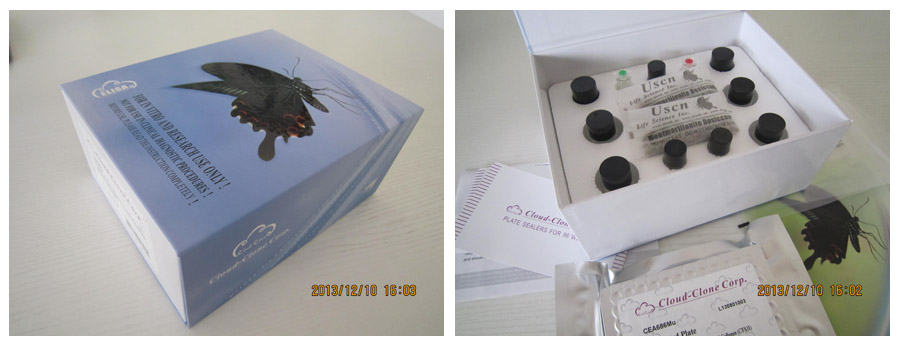 Recombinant Zeta Chain Associated Protein Kinase 70kDa (zAP70)