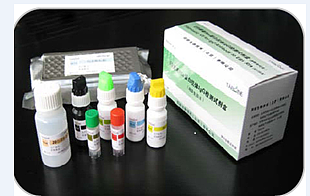 人抗髓过氧化物酶抗体（MPO Ab）定量检测试剂盒（ELISA）