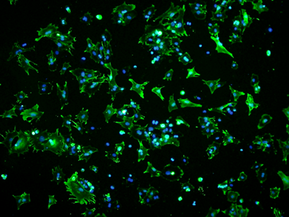 大鼠主动脉内皮细胞/免疫荧光鉴定/镜像绮点（Cellverse）