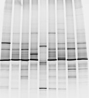 变性梯度凝胶电泳（PCR-DGGE）