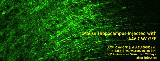 AAV1-GFP-Hippocampus.jpg