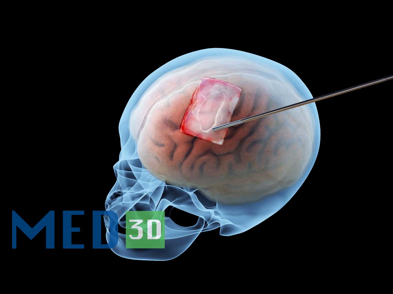  【高清】医学产品3D效果图制作