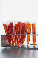 兔抗人B细胞CLL/淋巴瘤11A（锌指蛋白）多克隆抗体