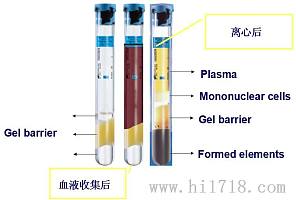 PRP美容管 PRP一次性采血管 PRP采血管