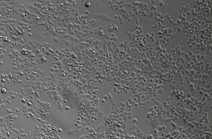 RBMVEC细胞；大鼠脑微血管内皮细胞