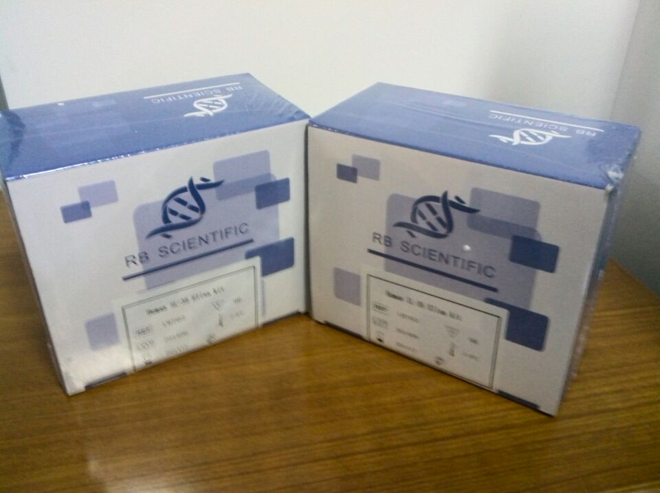 人超氧化物歧化酶(SOD)酶联免疫试剂盒