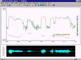 巴西VoxMetria嗓音声学检测分析软件(中国总代)