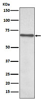 NF-kB p65 Antibody(CY5034)