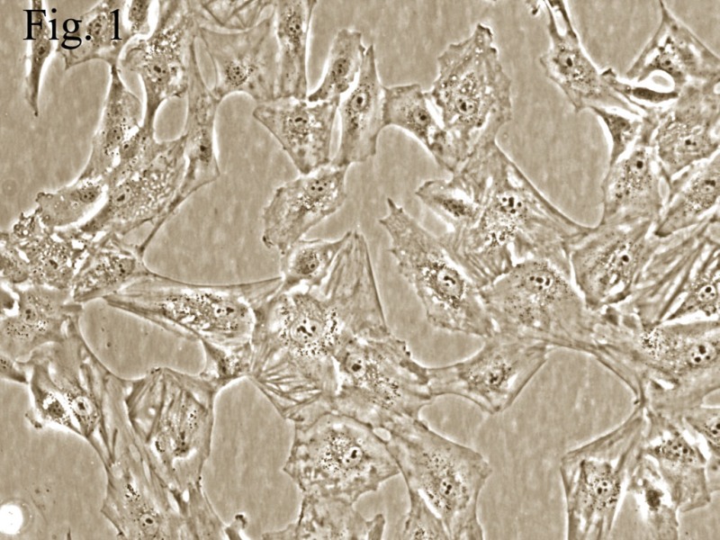 人绒毛膜滋养层细胞