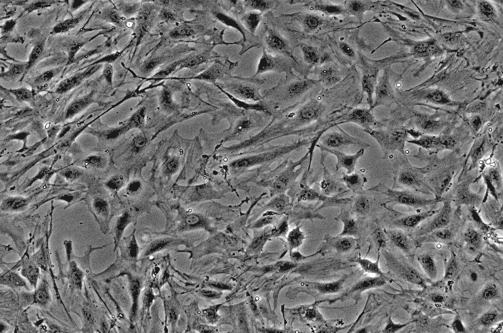 肾小球系膜细胞(RMC)