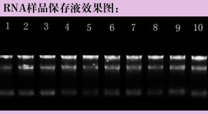 GR1401-100ML RNA 样品保存液 