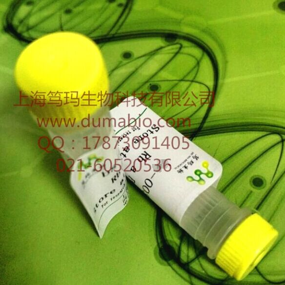 人皮肤T细胞虏获趋化因子(CTACK)酶联免疫试剂盒