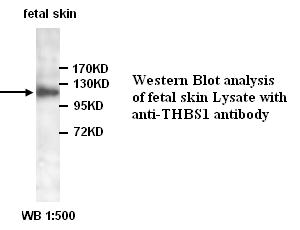 THBS1 抗体