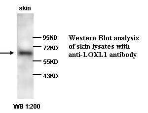 LOXL1 抗体