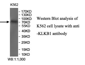 KLKB1抗体