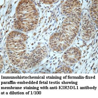 KIR3DL1抗体