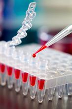 子科供应人血管内皮生长因子受体（VEGFR）ELISA检测试剂盒