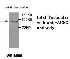 ACE2 抗体