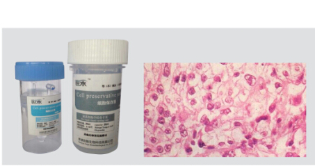 液基细胞保存液