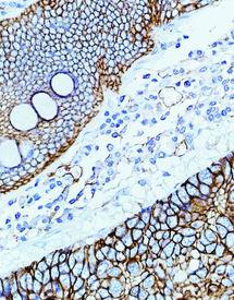 小鼠 P-糖蛋白(C494) 单克隆抗体