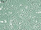 JEG-3/VP16-IL-2细胞、白介素-2转染耐VP16绒癌细胞