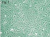 JCA-1细胞、人前列腺癌细胞