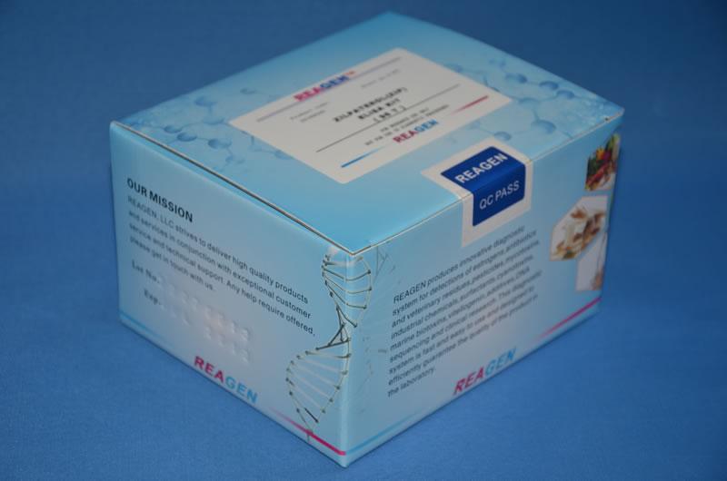 人PL12抗体/抗丙氨酰tRNA合成酶(PL12/AlaRS)elisa试剂盒