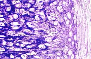 抗人转铁蛋白单抗杂交瘤细胞;Ferritin-1说明书