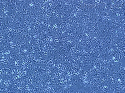 小鼠肾小管上皮细胞 TCMK-1