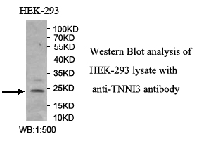TNNI3抗体