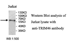 TRIM46抗体