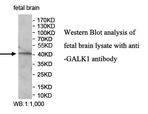 GALK1抗体