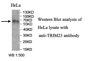 TRIM23抗体