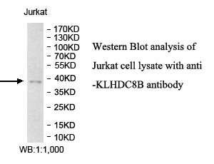 KLHDC8B抗体