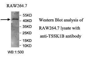 TSSK1B抗体
