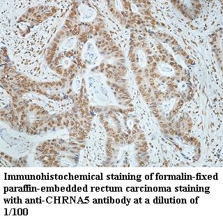 CHRNA5抗体