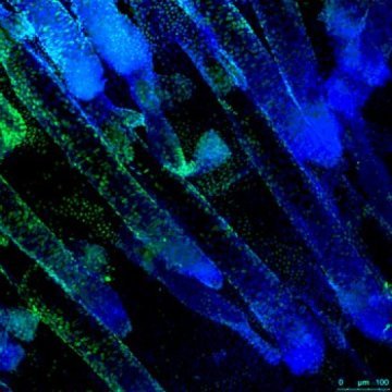 PC-12(未分化)细胞