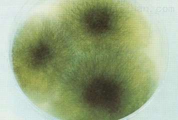 北纳创联具核梭杆菌多形亚种 ATCC 10953